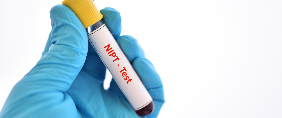 Eine behandschuhte Hand hält ein Reagenzglas mit der Aufschrift "NIPT - Test", das eine Blutprobe enthält.